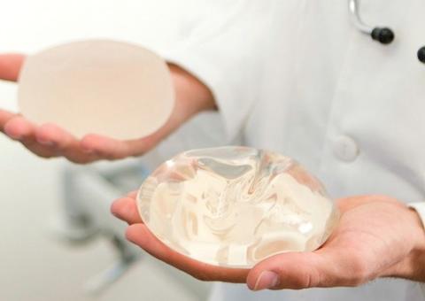 Fabricante anuncia recall mundial de implantes de silicone; Brasil tem 3 produtos na lista