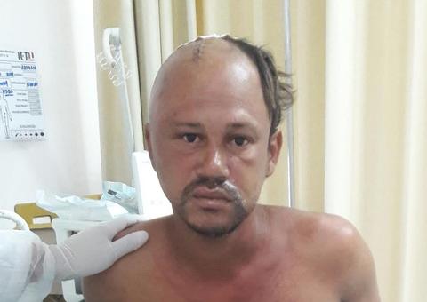 Hospital procura por familiares de paciente atropelado em Manaus 