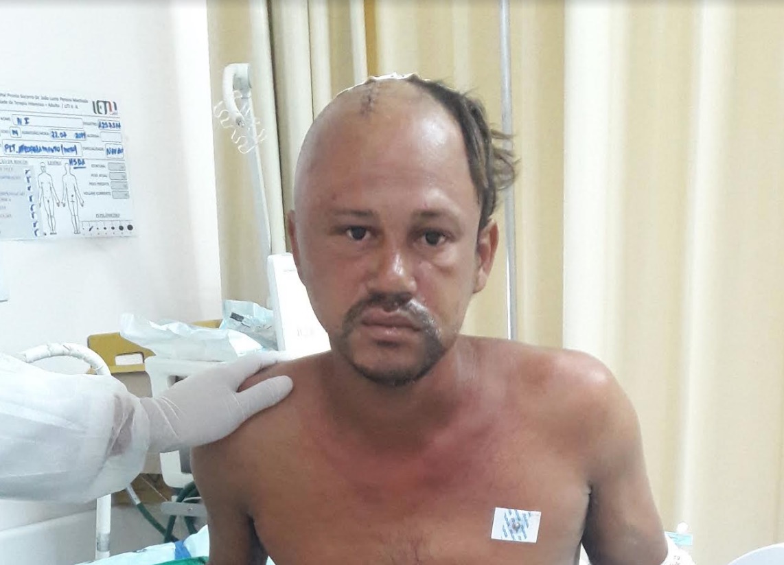 Hospital procura por familiares de paciente atropelado em Manaus 