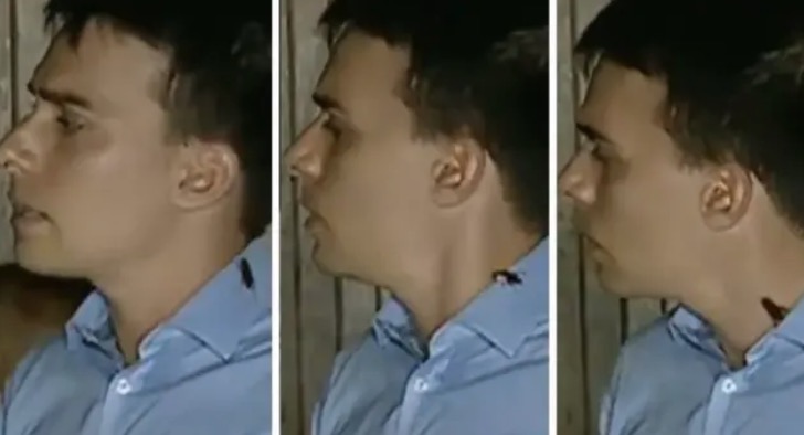 Barata sobe em pescoço de repórter durante ao vivo; assista