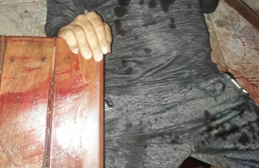 Amigos são baleados por pistoleiros misteriosos na frente de bar no Amazonas