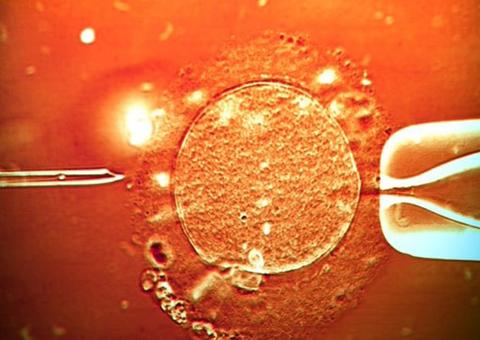 Acusado de abuso sexual, milionário queria 'semear a raça humana' com seu DNA 