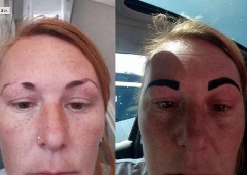 Mulher fica com sobrancelha de ‘Angry Birds’ após procedimento dar errado
