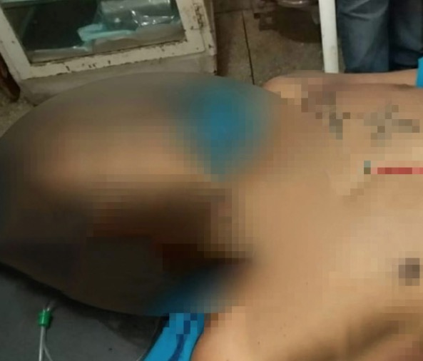 No Amazonas, adolescente é baleado na frente de amigos em bar