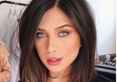 Flávia Pavanelli choca ao mostrar rosto cheio de acne e fala sobre tratamento