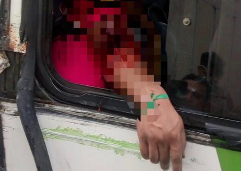 Homem corre risco de ser amputado após ter braço atingido por ônibus em rua de Manaus