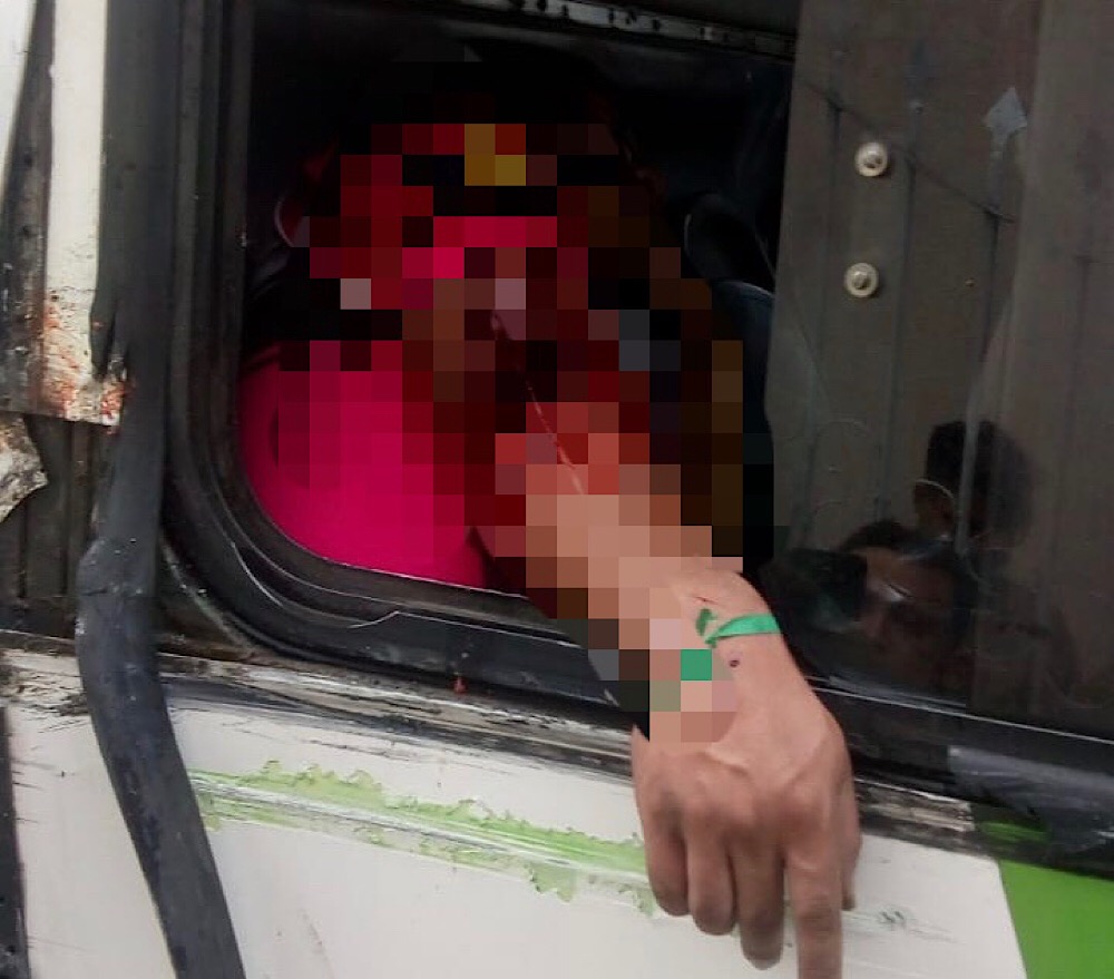 Homem corre risco de ser amputado após ter braço atingido por ônibus em rua de Manaus