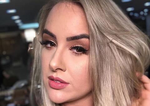 Ex-bbb Patrícia Leitte mostra antes e depois de harmonização facial