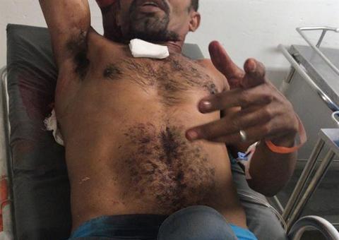 Mulher ataca companheiro com faca de serra após ele se atrasar para almoço