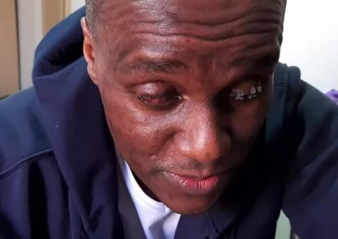 Médico atacado por agente penitenciário está cego: 'tenho medo de ser morto'