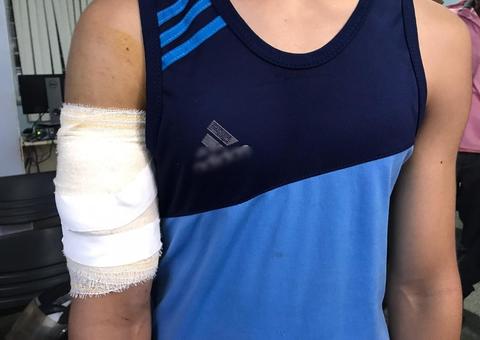 Em Manaus, adolescente é esfaqueado no braço ao entregar celular durante assalto