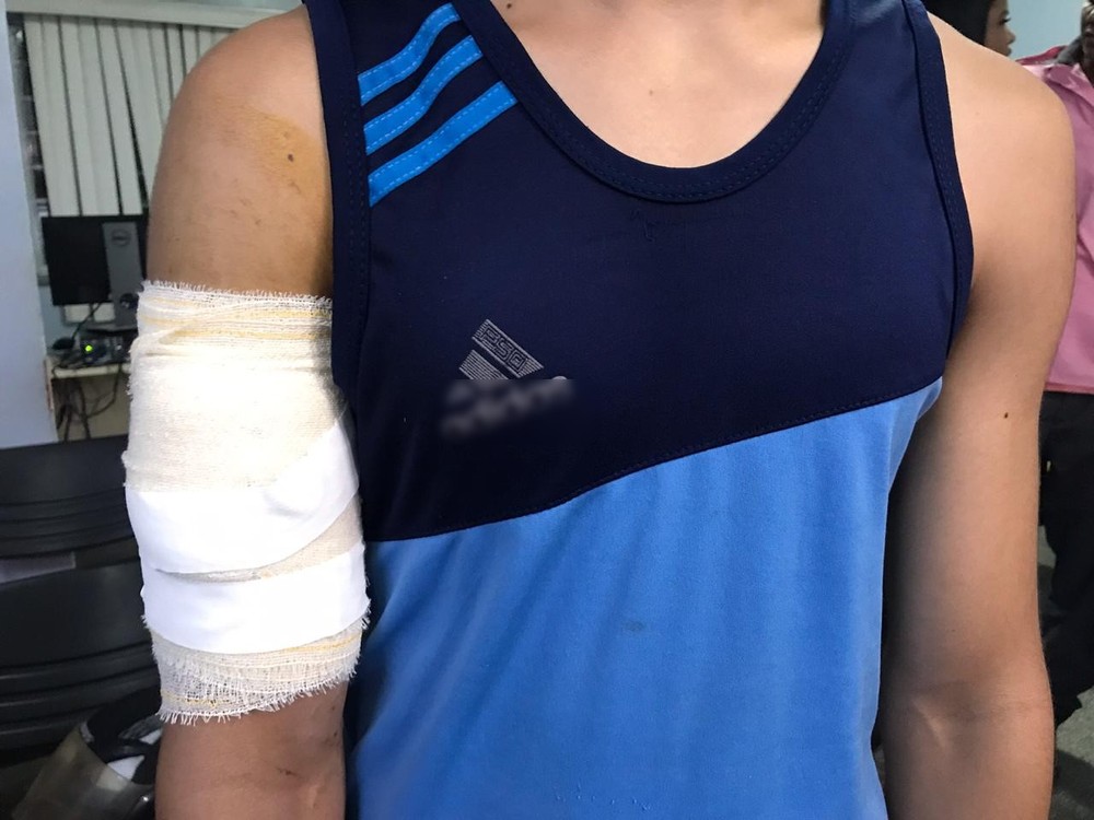 Em Manaus, adolescente é esfaqueado no braço ao entregar celular durante assalto