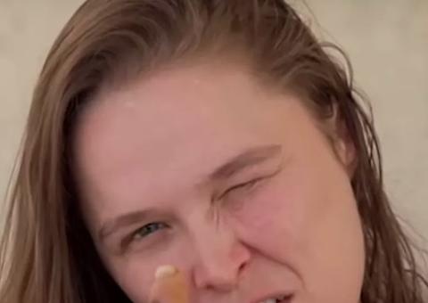 Ronda Rousey mostra dedo costurado após acidente 