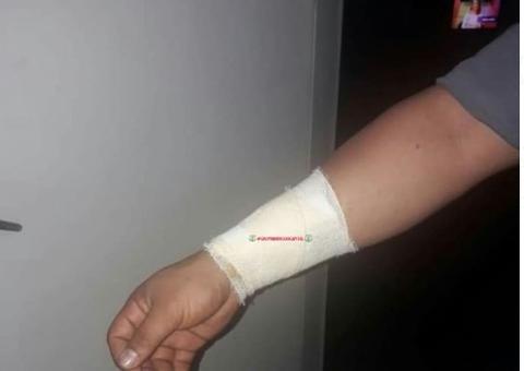 Traficante surta durante prisão e abocanha braço de PM em Manaus