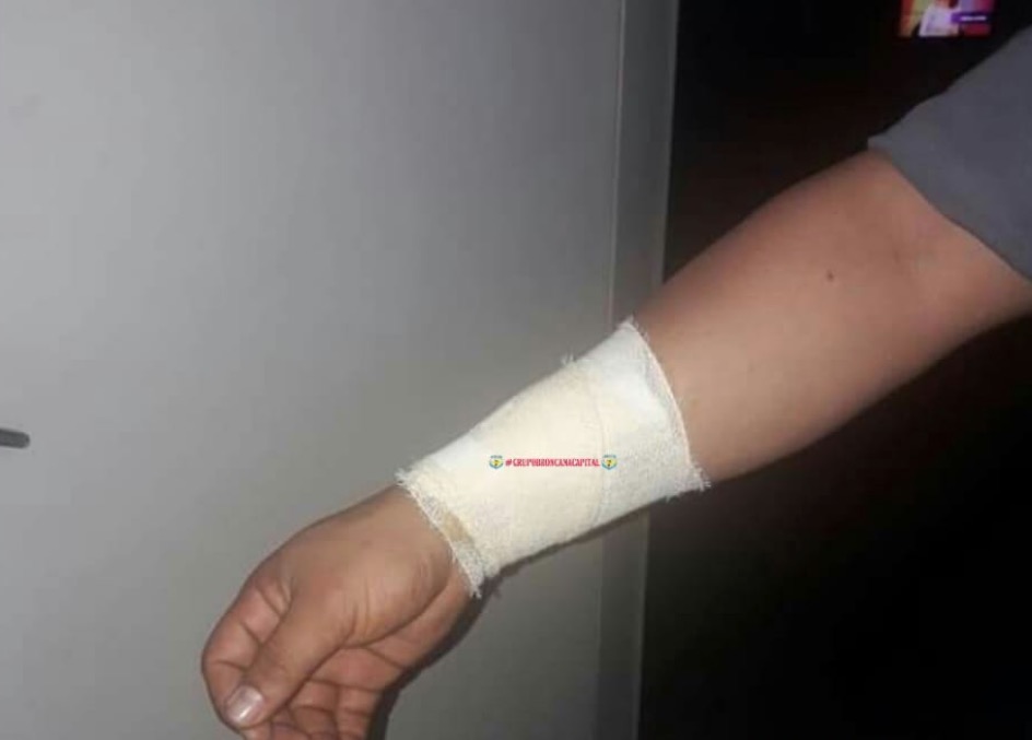 Traficante surta durante prisão e abocanha braço de PM em Manaus