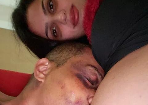 Após acidente, vocalista do Sampa Crew faz post emocionante e mostra hematomas 