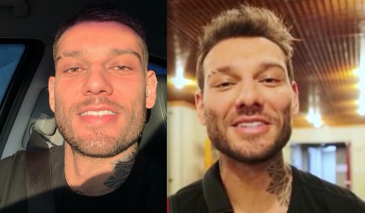Lucas Lucco aparece com rosto diferente e é criticado por suposta harmonização facial