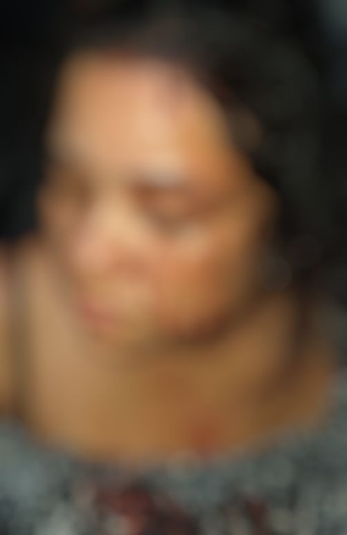Mulher é agredida com garrafada na cabeça pelo marido durante discussão em Manaus 