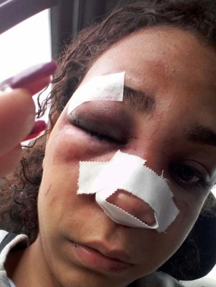 Com ciúme, homem quebra nariz de ex-mulher na frente da filha de 2 anos