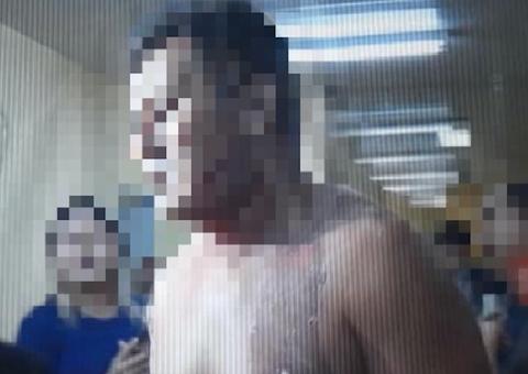 Briga de casal termina com mulher baleada e homem queimado com água quente em Manaus 