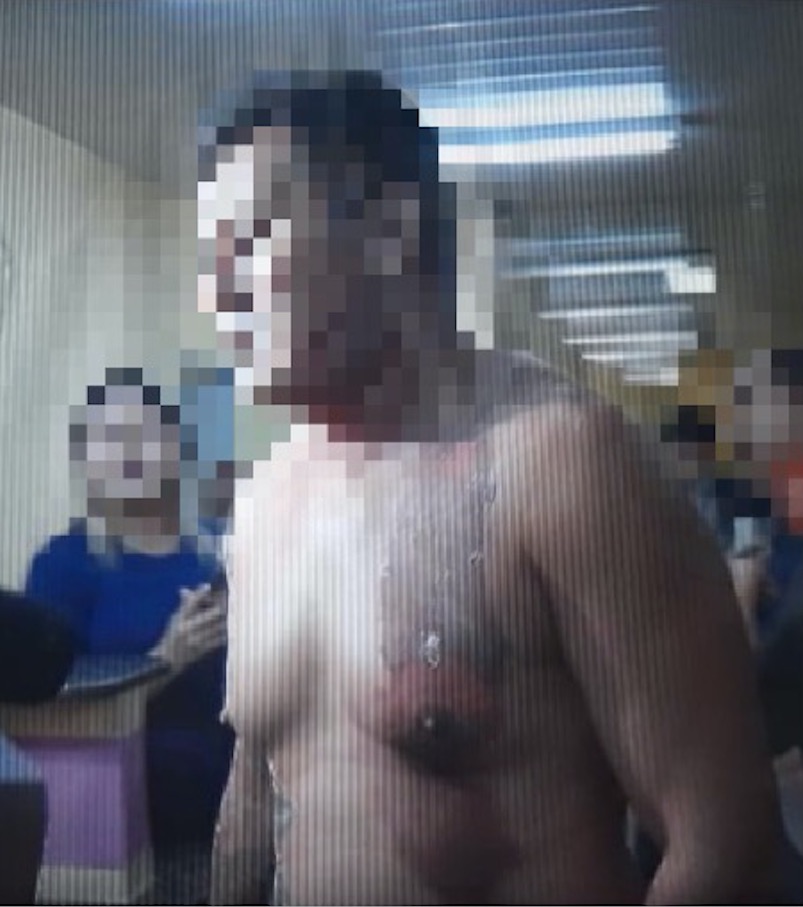 Briga de casal termina com mulher baleada e homem queimado com água quente em Manaus 