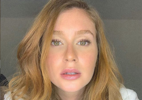  Atriz nega botox e explica: “Tô com herpes"