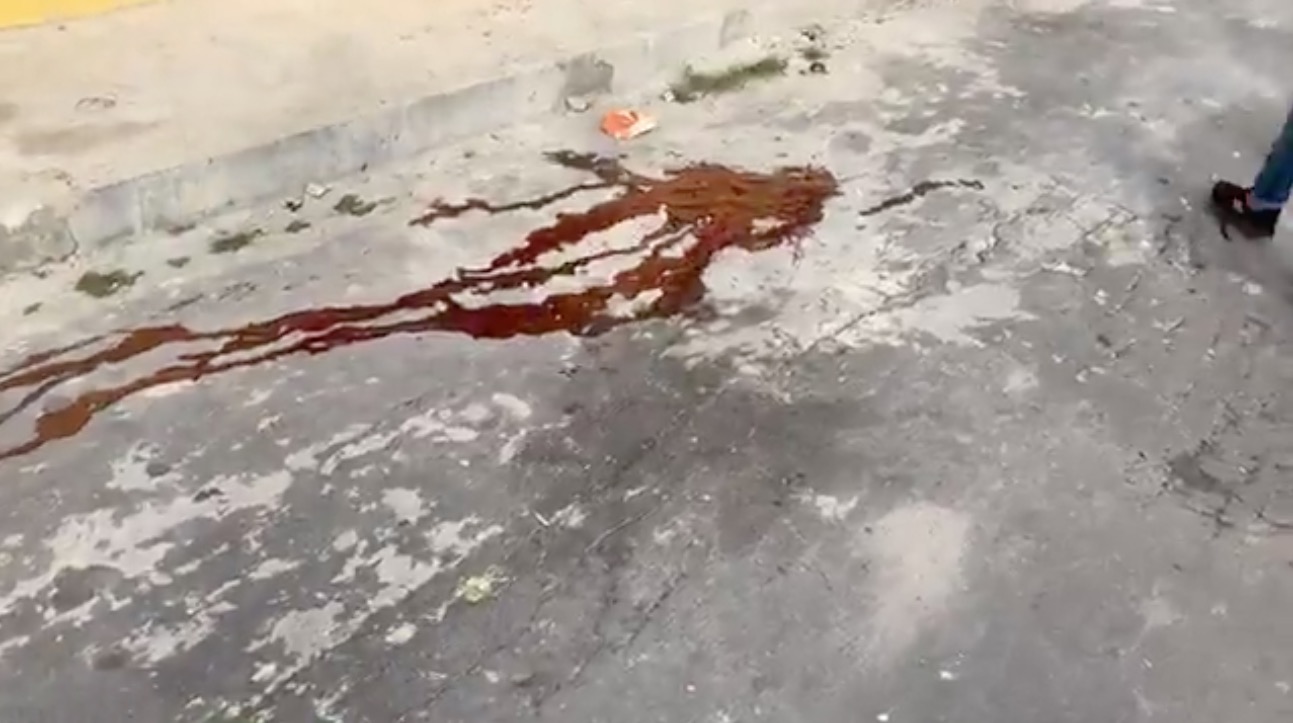 Homem é baleado na cabeça por dupla de motoqueiros em Manaus 