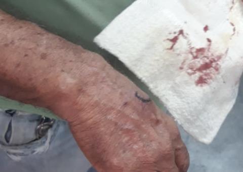 Dupla é presa suspeita de morder idoso para roubar dinheiro de aposentaria em Manaus 