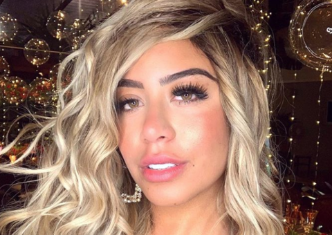 Rafaella Santos faz preenchimento labial e resultado choca seguidores; confira 