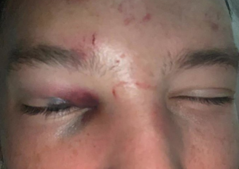 Jogador de seleção é espancado ao insistir sair com namorada de outro atleta