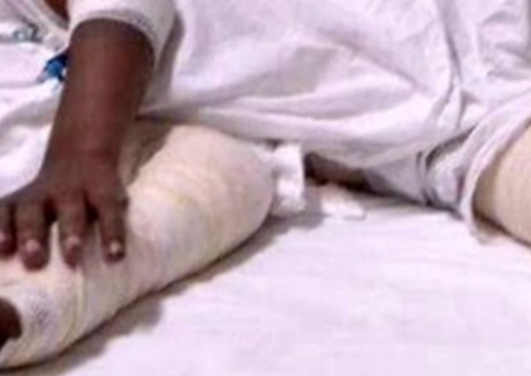 Avó é suspeita de jogar água quente em neto que não queria tomar banho