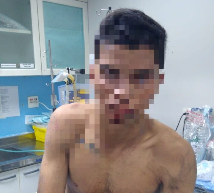 Em Manaus, suposto assaltante é abandonado por comparsa e espancado por populares