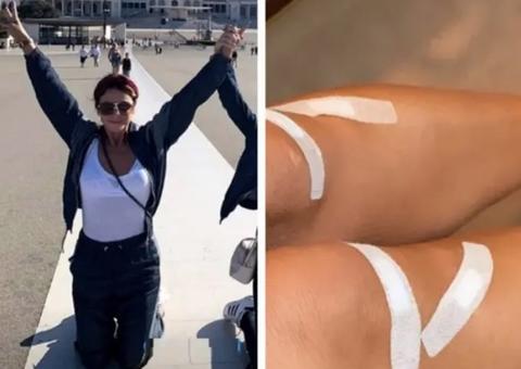 Giovanna Antonelli mostra foto do joelho após pagar promessa