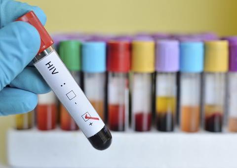 Pesquisa detalha distribuição dos subtipos do HIV no Brasil