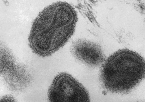 Laboratório com grande estoque de vírus mortais explode na Sibéria