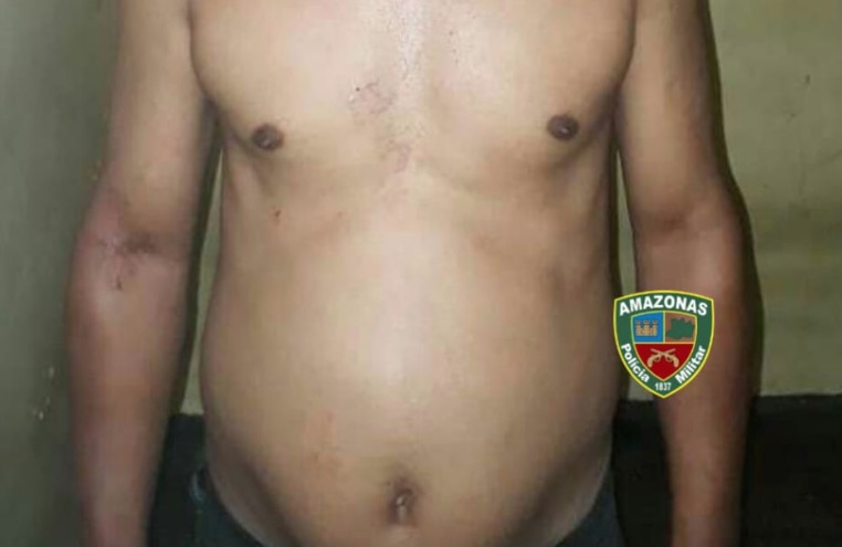 Homem é linchado após sequestrar, agredir e estuprar ex-mulher em Manaus