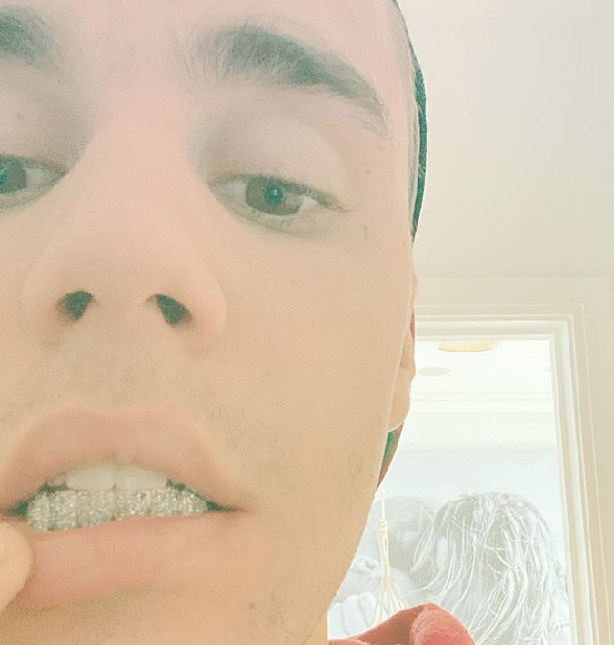 Justin Bieber exibe dentes de diamante e choca fãs 