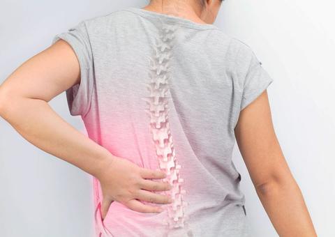 Atividade física é importante para quem tem osteoporose e também como prevenção à doença