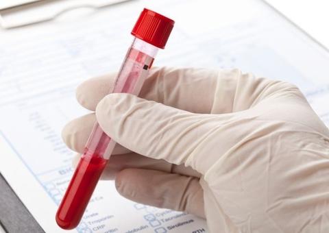 CCJ aprova teste de gravidez em demissão de funcionária