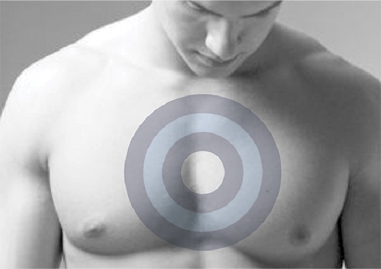 Cinco sinais que podem detectar o câncer de mama masculino