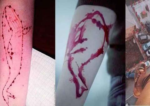 CCJ aprova tipificação do crime de induzir adolescentes a se automutilarem