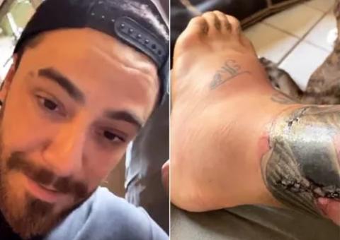 Felipe Titto tem infecção em perna após mordida de cachorro 