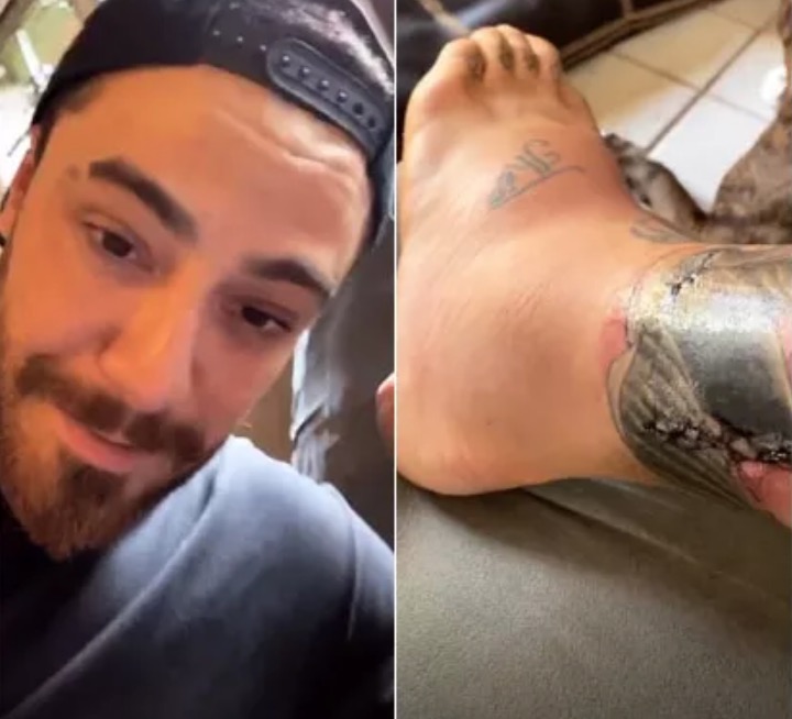 Felipe Titto tem infecção em perna após mordida de cachorro 