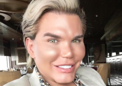 Ken Humano retira gordura das costas e implanta no bumbum