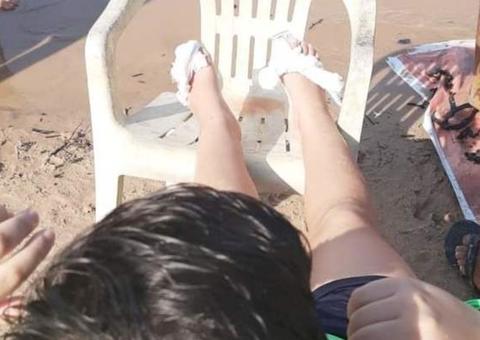 Criança perde parte do dedo ao ser atacada por piranhas em praia de Manaus