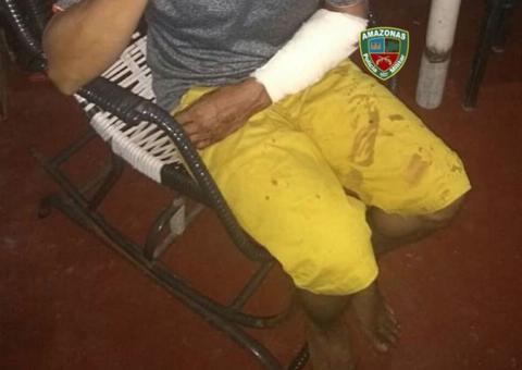 Durante ataque de fúria, pitbull ataca o próprio dono e é sacrificado em Manaus