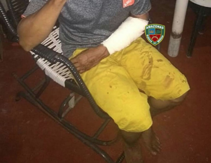 Durante ataque de fúria, pitbull ataca o próprio dono e é sacrificado em Manaus