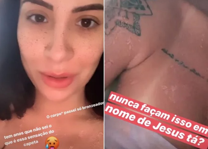Blogueira Bianca Andrade fica com queimaduras no corpo após passar bronzeador em casa