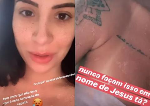 Blogueira Bianca Andrade fica com queimaduras no corpo após passar bronzeador em casa