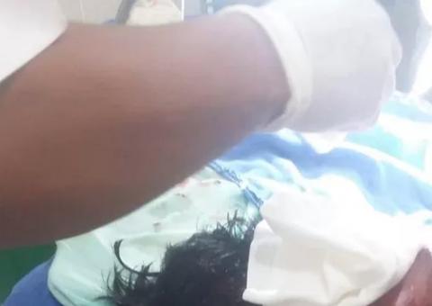 Homem tem rosto desfigurado por ataque de onça